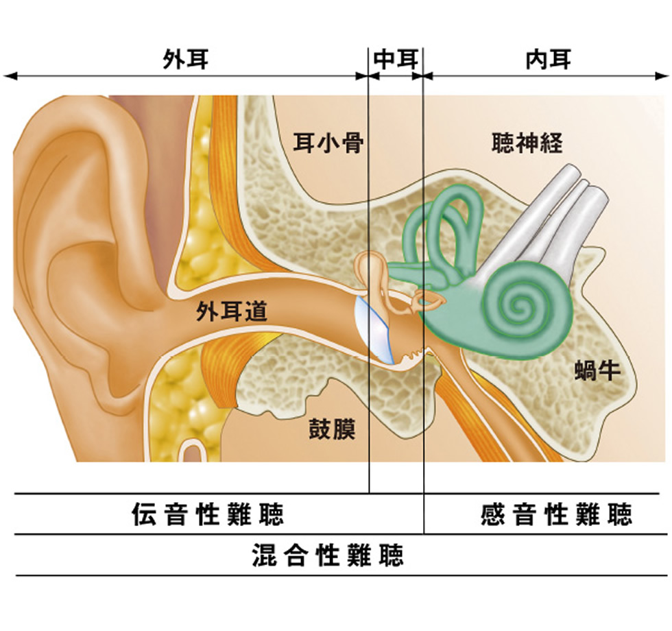 補聴器カタログ